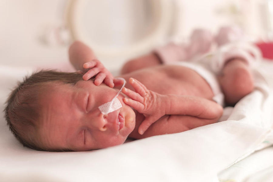 Israeli Study: Premature Babies Face Fertility Issues