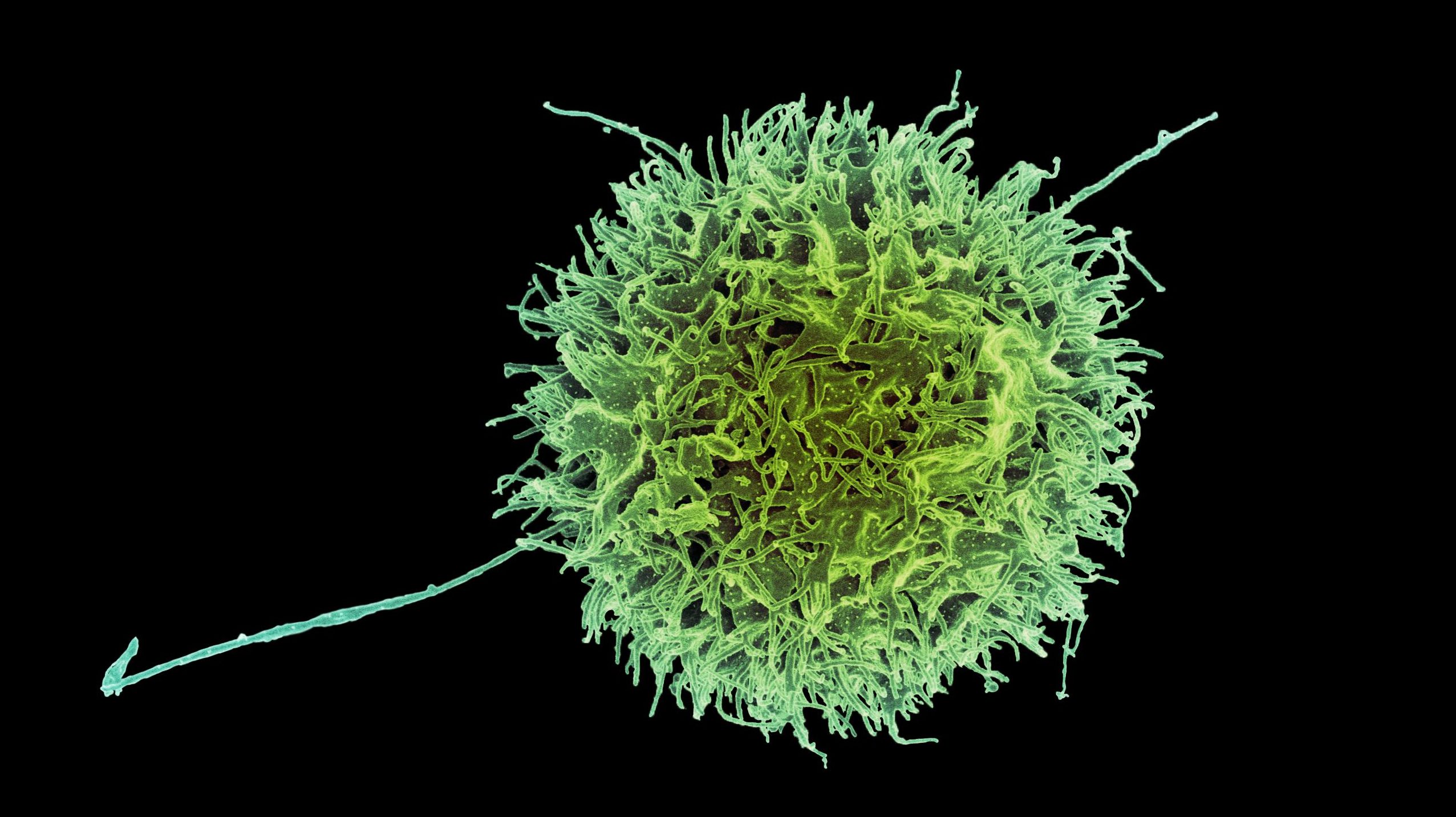 Novel Nanotechnology That Combats Cancer Cells Developed at Bar-Ilan University