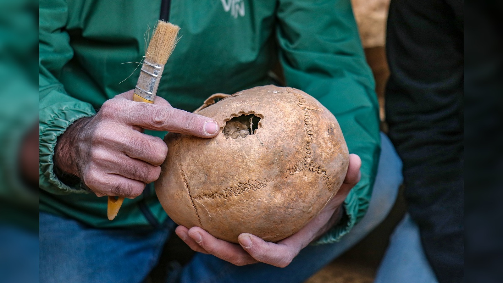 3,200-Year-Old Skulls With Surgical Evidence Found in Eastern Turkey