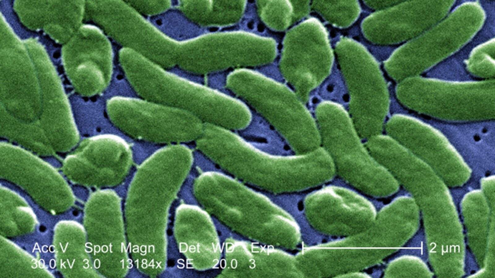 Drug-Resistant Bacteria Found in Israeli Coastal Waters Raise Health Alarm
